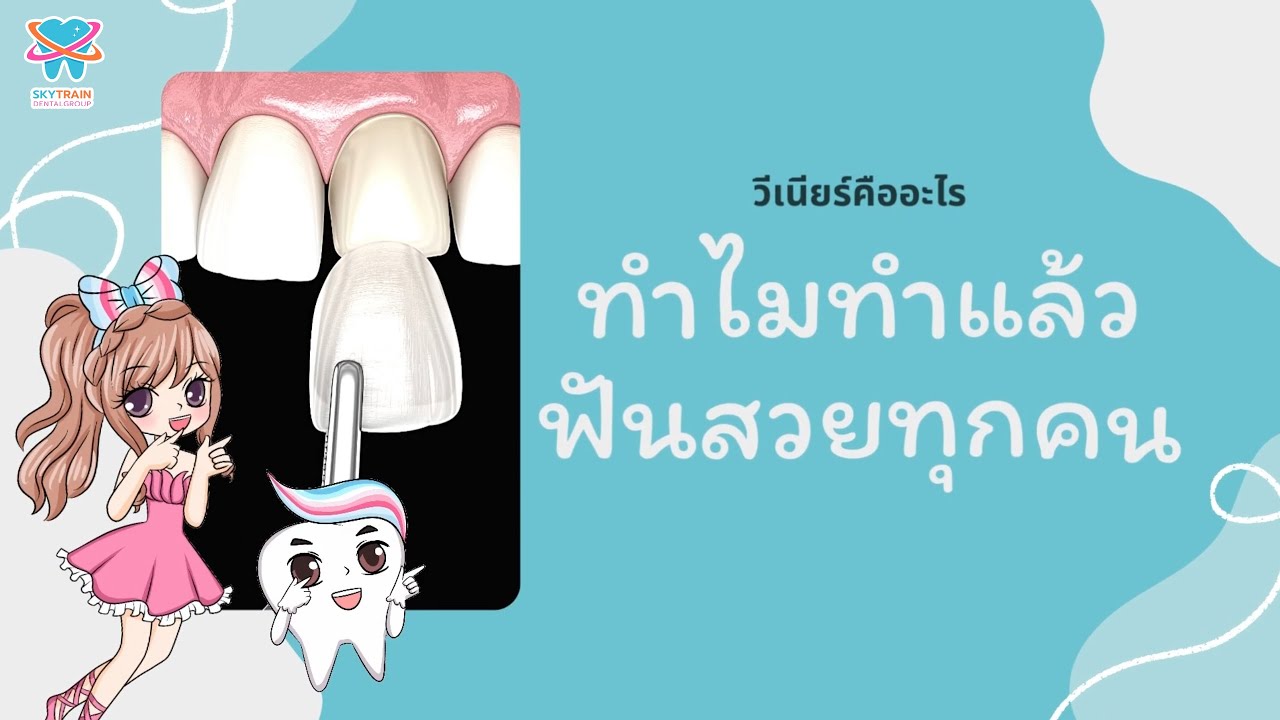 วีเนียร์คืออะไร ทำไมทำแล้วฟันสวยทุกคน | Skytrain Dental