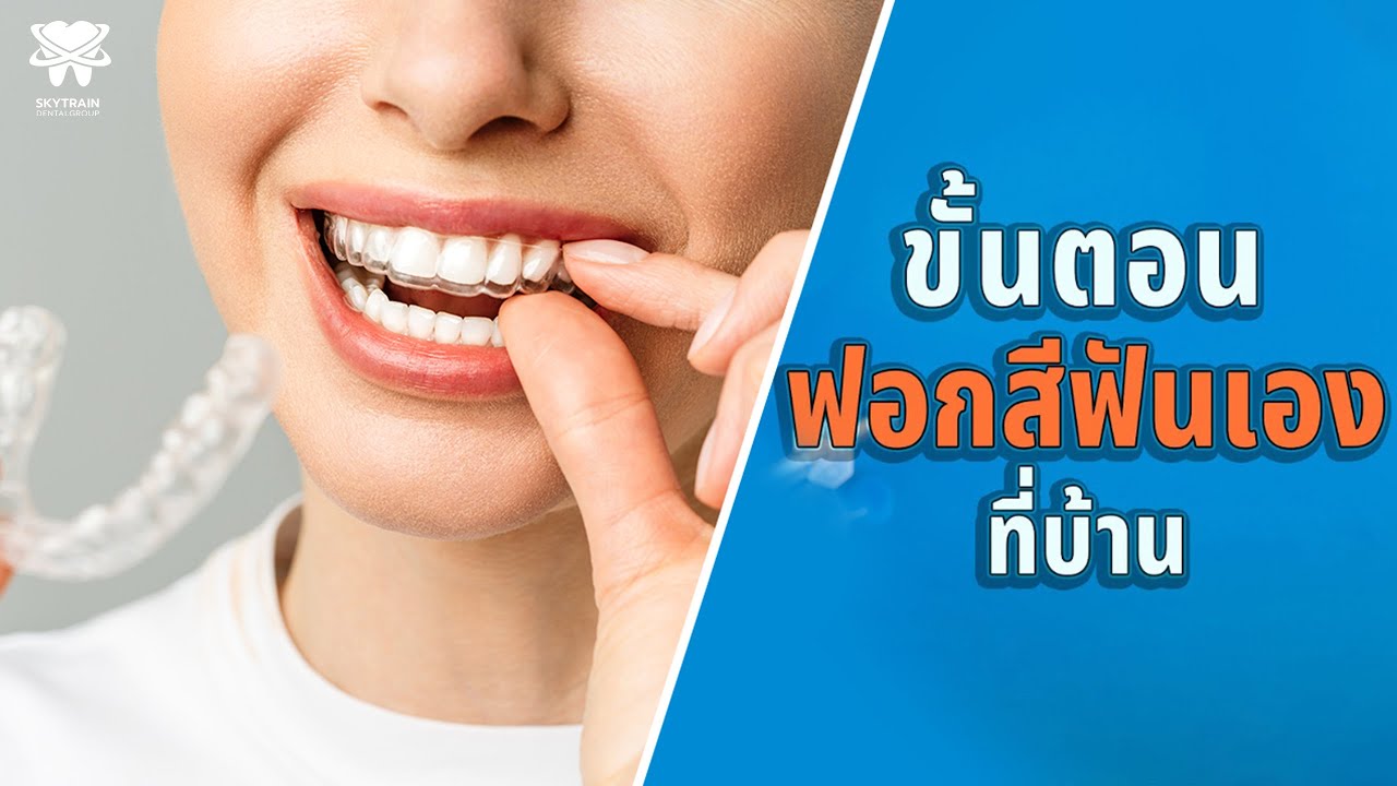 ขั้นตอนฟอกสีฟันเองที่บ้าน | Skytrain Dental
