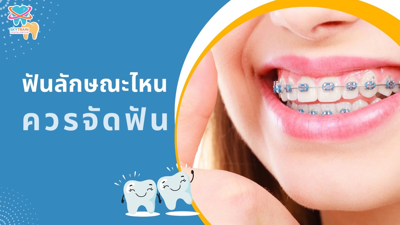 ฟันลักษณะไหนควรจัดฟัน | Skytrain Dental