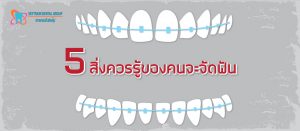 5 สิ่งควรรู้ของคนจะจัดฟัน