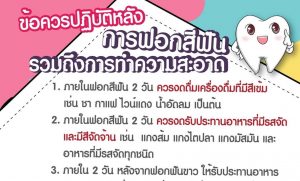 ข้อควรปฏิบัติหลังฟอกสีฟัน