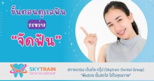 6 ขั้นตอนดูแลฟันระหว่างจัดฟัน