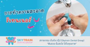 การทำความสะอาดรีเทนเนอร์