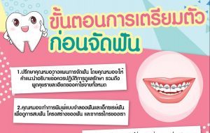 Orthodontic Treatment Procedure