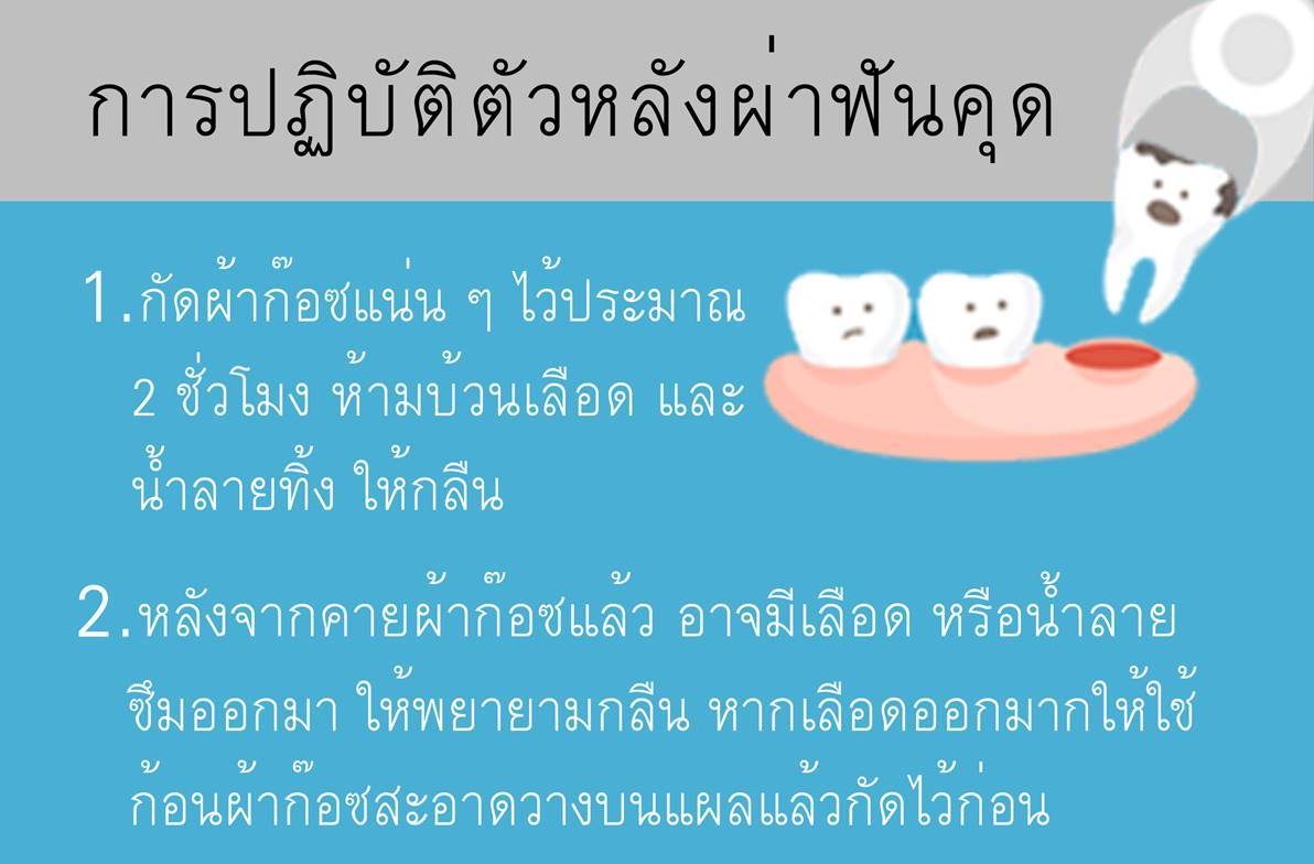 หลังผ่าฟันคุด กินได้ตอนไหน