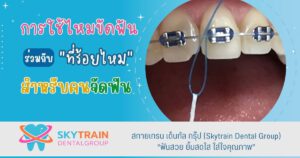 การใช้ไหมขัดฟันร่วมกับที่ร้อยไหม สำหรับคนจัดฟัน