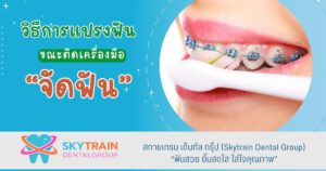 วิธีการแปรงฟันขณะติดเครื่องมือจัดฟัน
