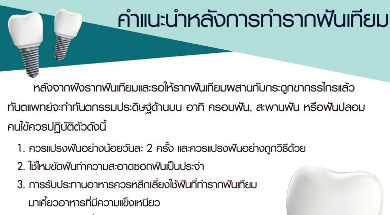 Recommendations after implant procedure