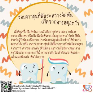 รอยขาวขุ่นที่ฟัน ระหว่างการจัดฟัน เกิดจากสาเหตุอะไร