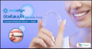 [ข้อควรรู้] จัดฟันแบบใส (Invisalign) ข้อดี-ข้อเสีย