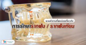 [FAQs] การรักษารากฟัน และการใส่ รากฟันเทียม