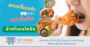 อาหารที่แนะนำ และควรหลีกเลี่ยง สำหรับคนจัดฟัน