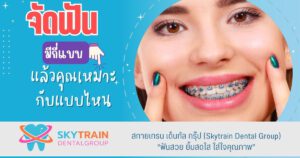 จัดฟันมีกี่แบบ แล้วคุณเหมาะกับแบบไหน