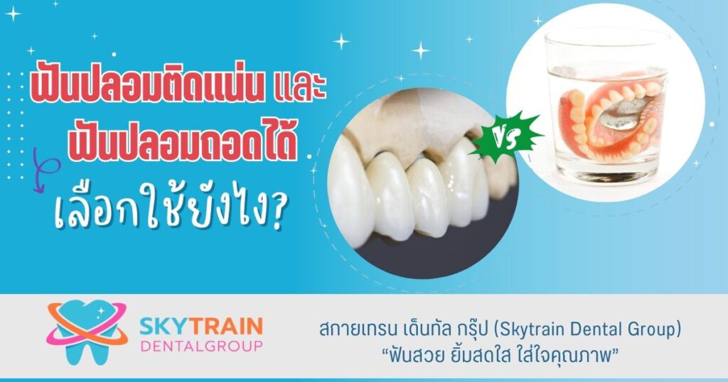 ฟันปลอมติดแน่น และฟันปลอมถอดได้ เลือกใช้ยังไง