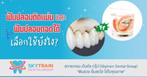 ฟันปลอมติดแน่น และฟันปลอมถอดได้ เลือกใช้ยังไง