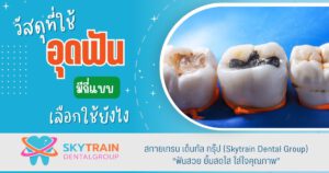 วัสดุที่ใช้อุดฟัน มีกี่แบบ เลือกใช้ยังไง