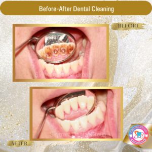 Dental Cleaning (6)