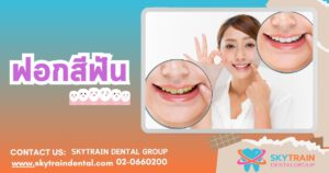 ฟอกสีฟัน ราคาเท่าไหร่ ? เปรียบเทียบราคาฟอกสีฟัน แบบต่างๆ