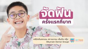 จัดฟันครั้งแรกกี่บาท ? สิ่งที่ต้องเตรียมตัว ก่อนเริ่มจัดฟัน