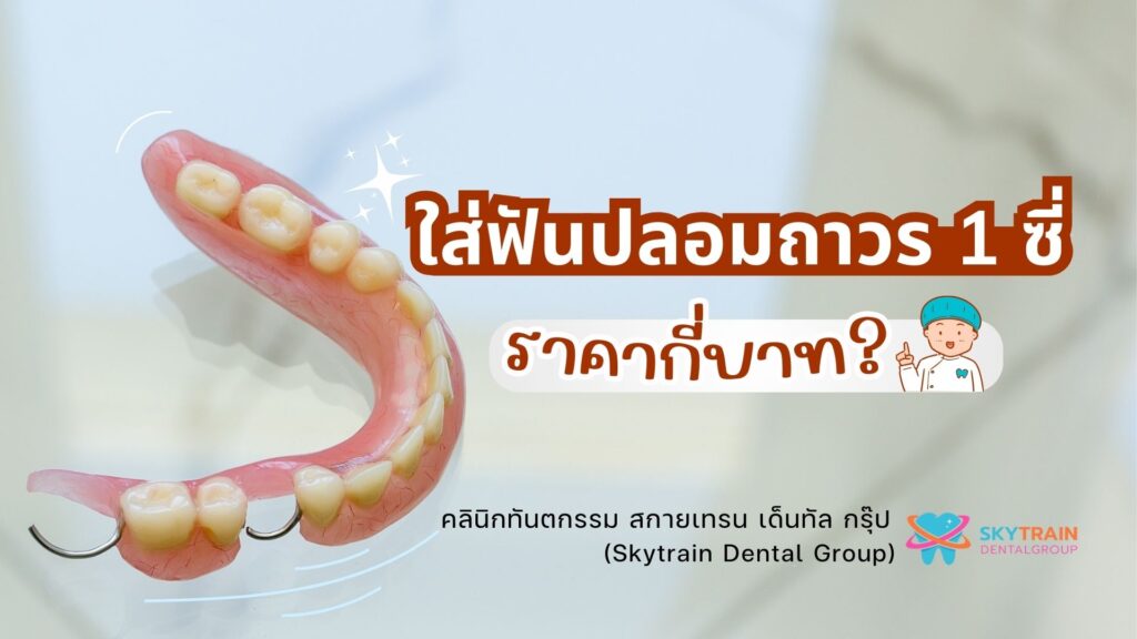 ใส่ฟันปลอมถาวร 1 ซี่ ราคากี่บาท