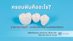 ครอบฟันคืออะไร? ราคาเท่าไหร่? ข้อควรรู้ก่อนตัดสินใจรักษา