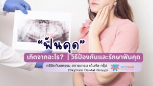 ฟันคุดเกิดจากอะไร ? วิธีป้องกันและรักษาฟันคุด