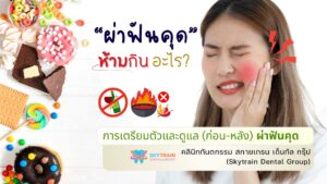 ผ่าฟันคุด ห้ามกินอะไร? การเตรียมตัวและดูแล (ก่อน-หลัง) ผ่าฟันคุด