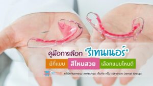 [คู่มือ] การเลือกรีเทนเนอร์ : มีกี่แบบ สีไหนสวย เลือกแบบไหนดี