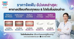 ราคาจัดฟัน 2569 อัปเดตล่าสุด: ตารางเปรียบเทียบทุกแบบ & โปรโมชั่นผ่อนชำระ