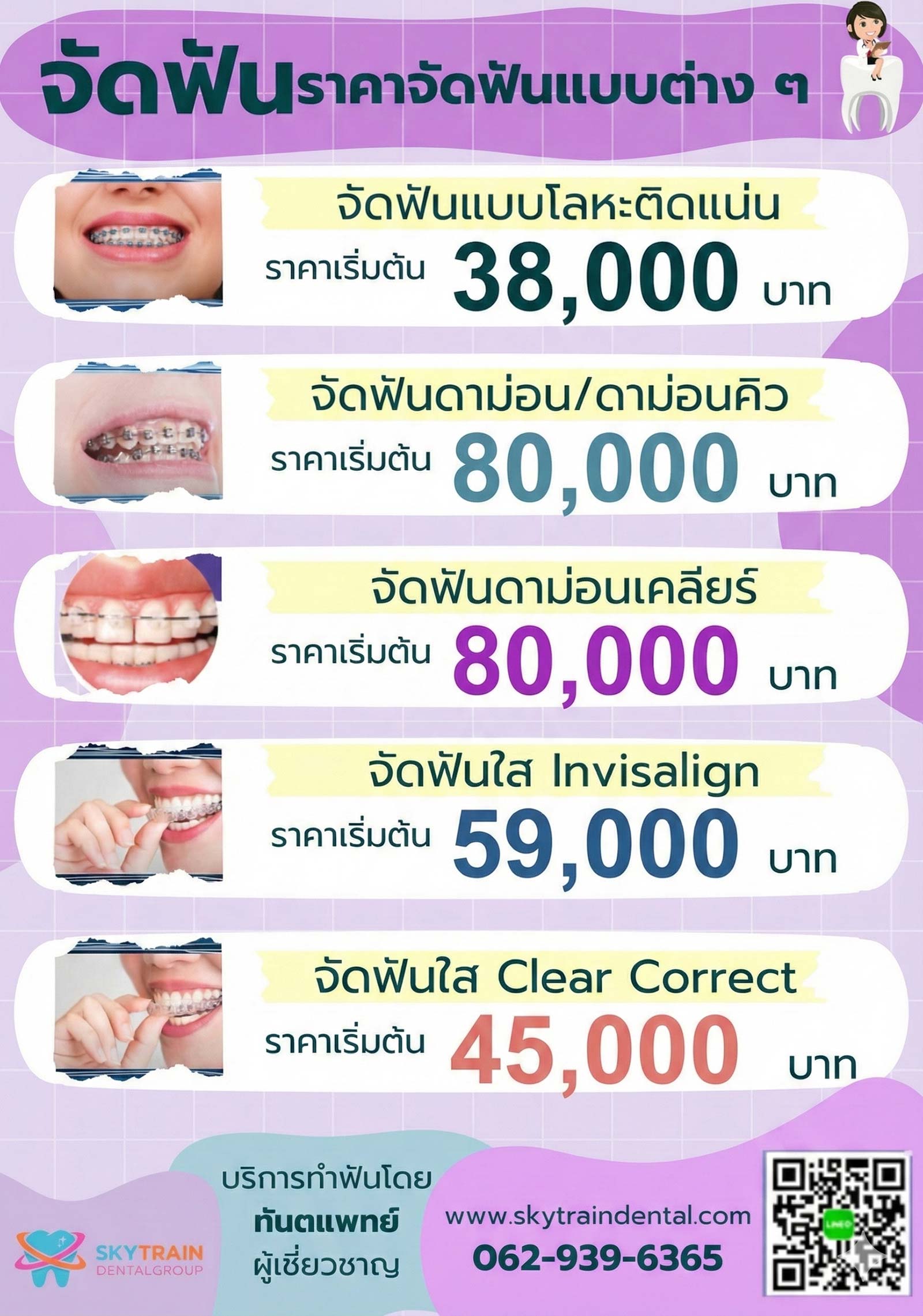 ราคาจัดฟัน อัปเดต 2569