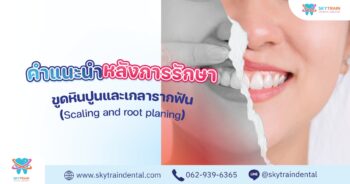 คำแนะนำหลังขูดหินปูน และเกลารากฟัน หลังขูดหินปูน