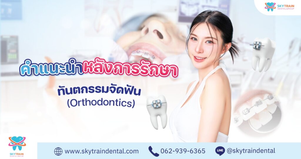 คู่มือคนจัดฟัน: คำแนะนำหลังติดเครื่องมือ เปลี่ยนยาง และรีเทนเนอร์