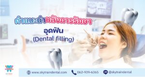 คำแนะนำหลังอุดฟัน (วัสดุสีเหมือนฟัน, อมัลกัม และ อินเลย์-ออนเลย์)