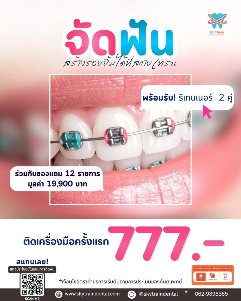 จัดฟัน 777