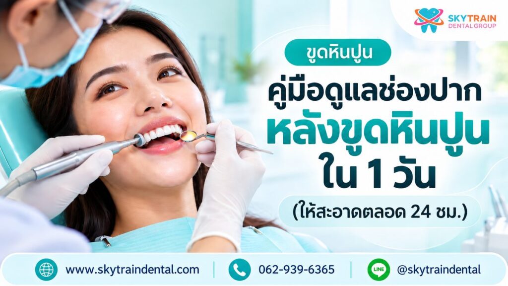 คู่มือดูแลช่องปากหลังขูดหินปูน ใน 1 วัน (ให้สะอาดตลอด 24 ชม.)